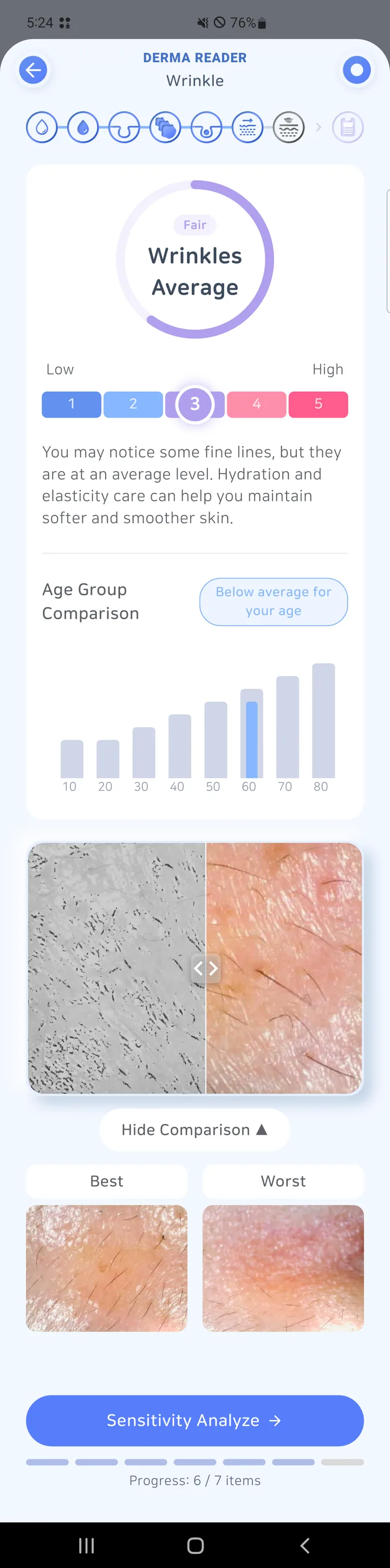 DERMA READER 주름 분석 결과 화면
