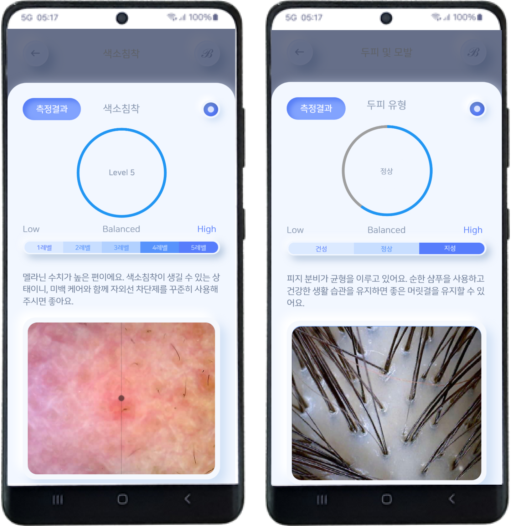 벨루스